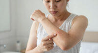 6 Signs Your Skin Needs Medical Attention, Stat