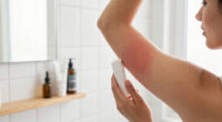 Deodorant Armpit Rash: Causes, Prevention, and Treatment