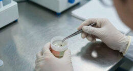 Cdc Parasite Outbreak